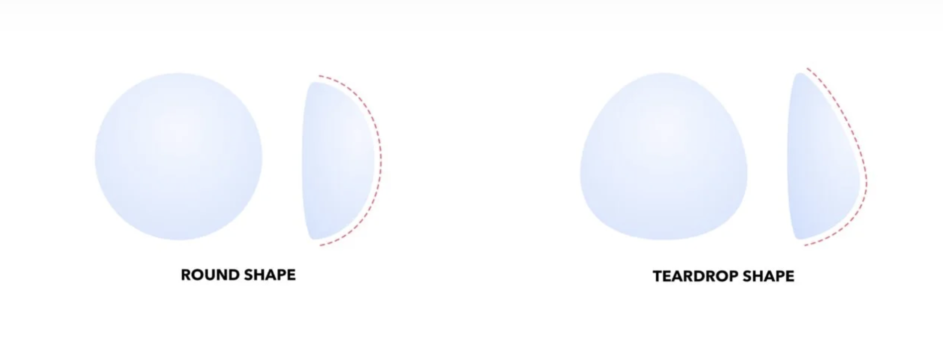 Breast Implants
